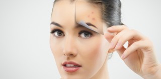 What Causes Pimples And Acne To Remove On Chin And Neck?