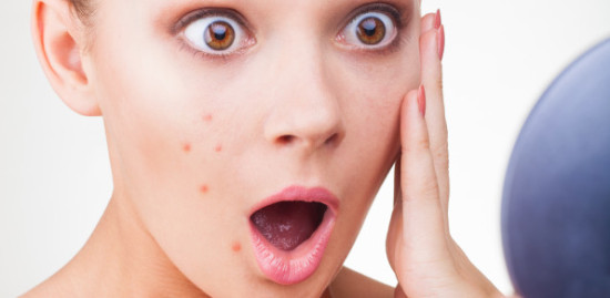 How To Handle Acne-Confessions Of An Acne Fighter