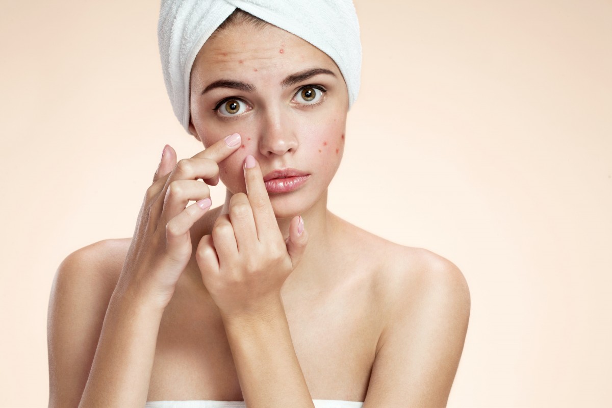 https://estilo-tendances.com/wp-content/uploads/2018/01/homeopathic-remedies-for-acne-1200x800.jpeg