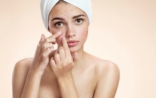 homeopathic remedies for acne